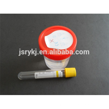 disposable 9.5ml Vacuum urine tube